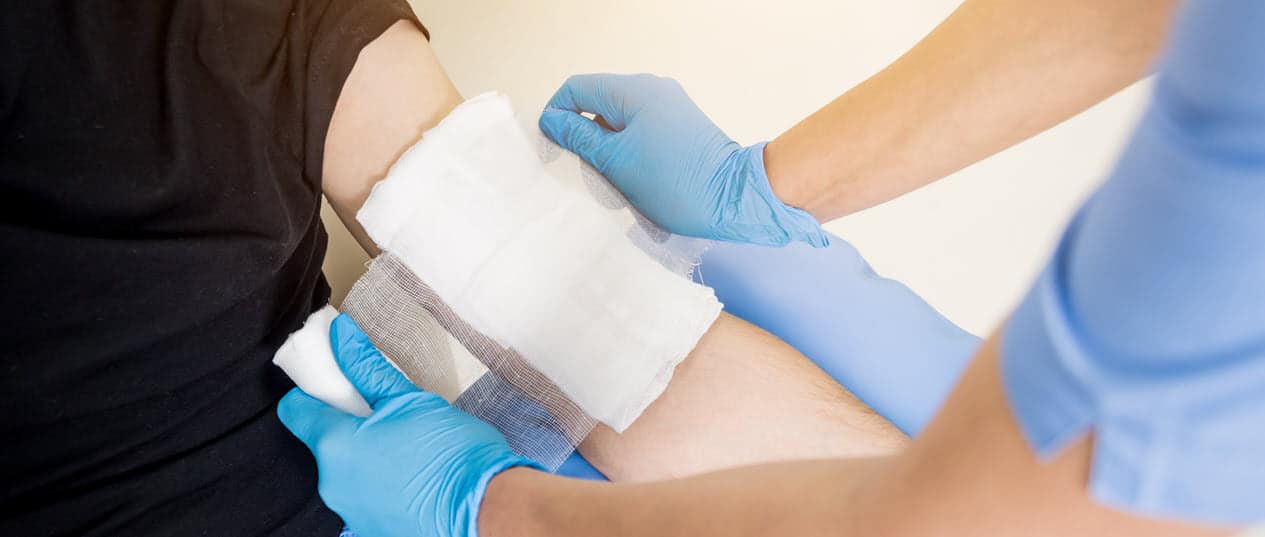 Olathe burn injury lawyers