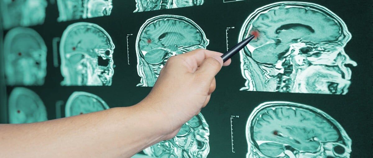 TBI Lawyers Blue Springs MO