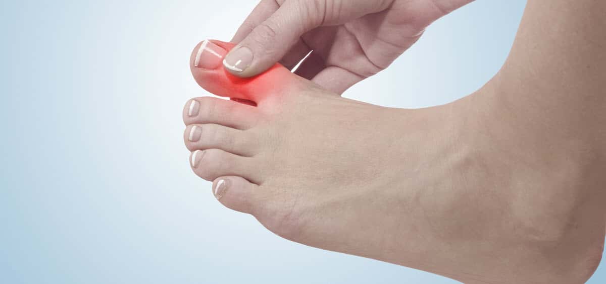 Cartiva Implant Failure