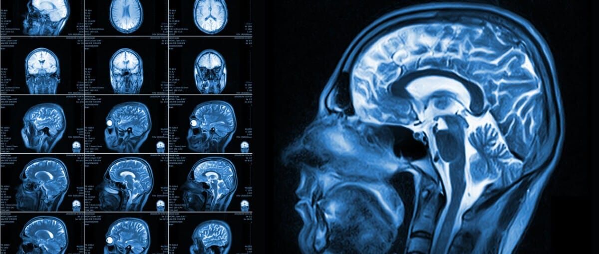 Overland Park Traumatic Brain Injury Lawyers