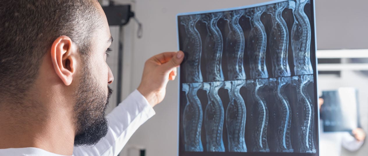 Olathe spinal cord injury lawyers